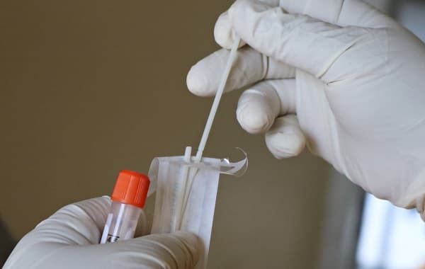 Delodajalci lahko uveljavljate povračilo sredstev za nakup hitrih antigenskih testov